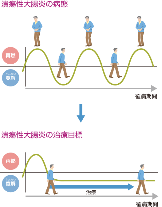 潰瘍性大腸炎の病態 潰瘍性大腸炎の治療目標