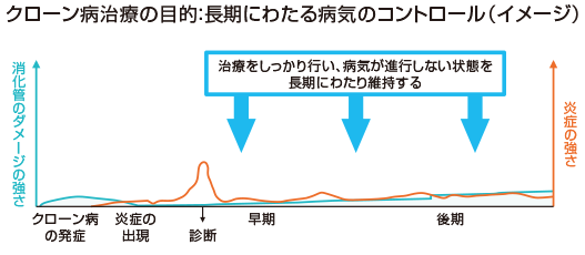 クローン病治療の目的 長期にわたる病気のコントロール