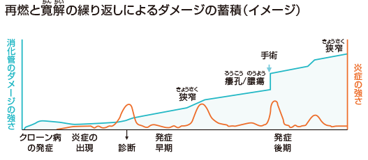 再燃と寛解の繰り返しのよるダメージの蓄積