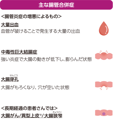 潰瘍性大腸炎の主な合併症
